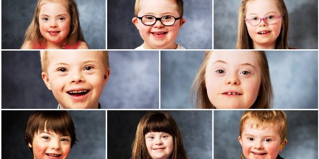 Down Syndrome